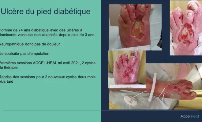 ACCEL HEAL, Saint-Paul, O2CM